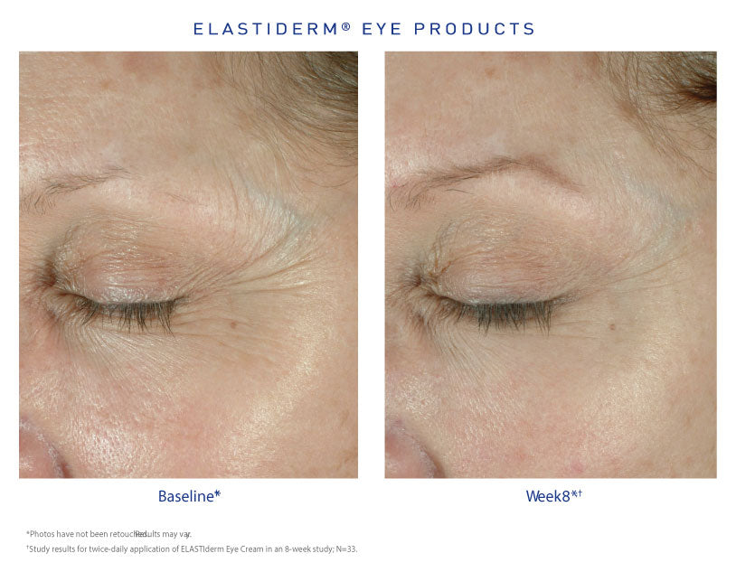 EYE CREAM