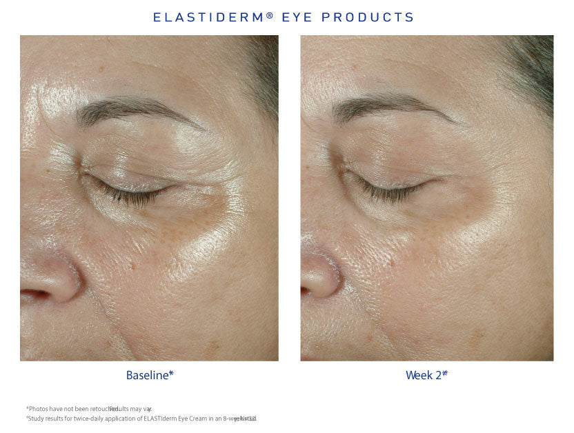 EYE CREAM